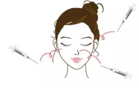 納米微針的作用?納米微針術后注意事項